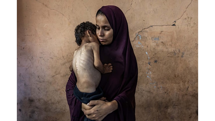 Il fotografo palestinese Saher Alghorra vince il Pulitzer 2026: le sue immagini raccontano l’inferno di Gaza tra fame e distruzione - greenMe
