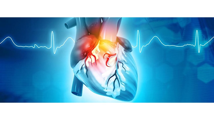 Geni killer e cicatrici sul cuore: ecco il perché degli infarti improvvisi (anche per chi stava bene) - panorama.it