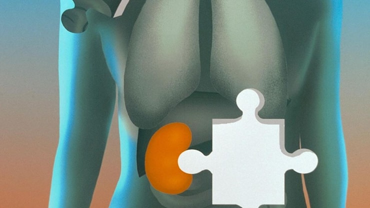 La malattia renale cronica colpisce più le donne: ecco perché - Tgcom24