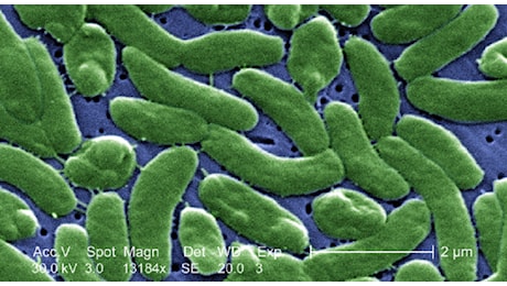 Batterio mangia-carne, l’allarme dell’Ecdc per l’estate 2026: cosa c’è da sapere