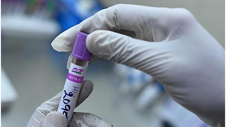 Diminuiscono i casi di Hiv in Sicilia, ma restano troppe le diagnosi tardive - la Repubblica