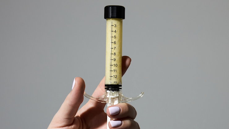 AlloClae, iniezioni di grasso di cadavere per dimagrire: dopo l’Ozempic arriva il nuovo folle metodo per rimodellare il corpo - La Nuova Sardegna