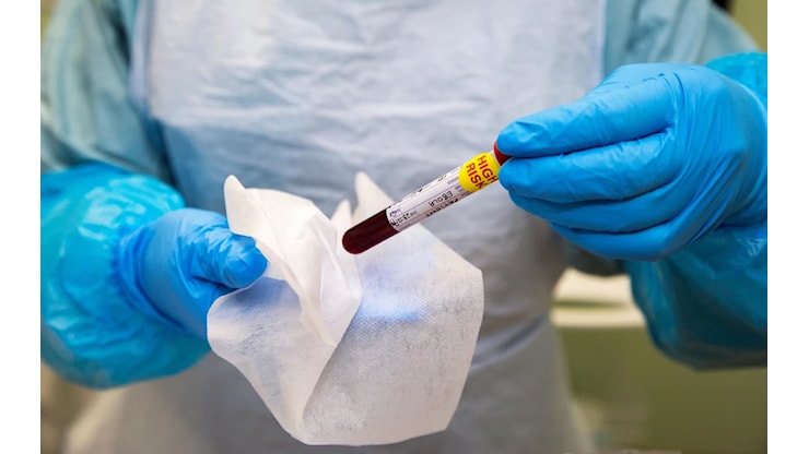Ebola, primo caso di contagio accertato in Francia: è un medico rientrato dal Congo - Sky TG24